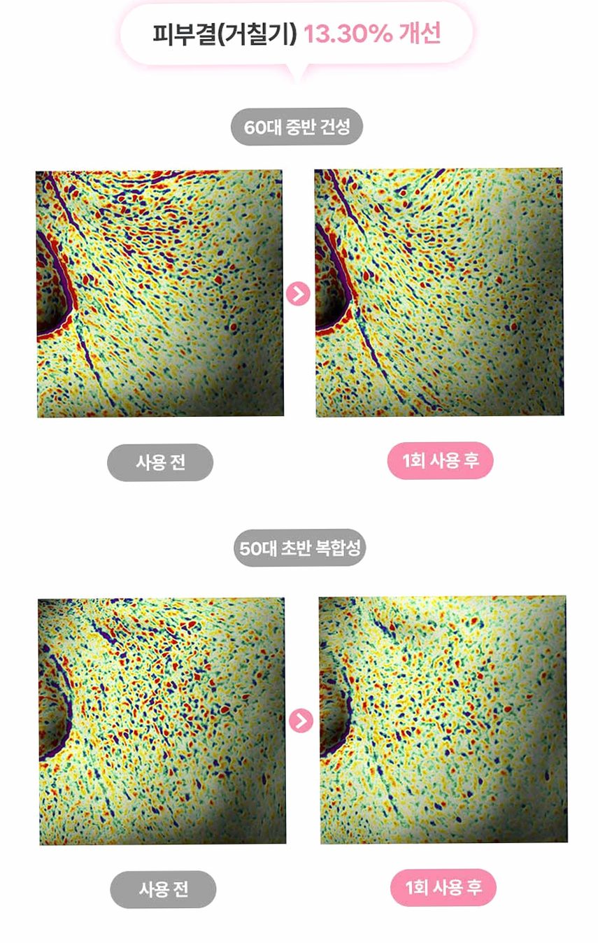 펄리 엑소좀 피부과재생크림 수분 보습 시카 히알루론산 물광크림 40ml, 1개